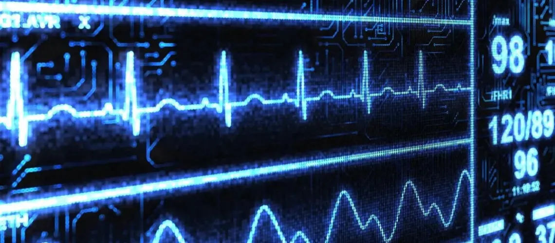 Η AI εντοπίζει καρδιακή ανεπάρκεια σε 2 δευτερόλεπτα μέσω απλού ηλεκτροκαρδιογραφήματος