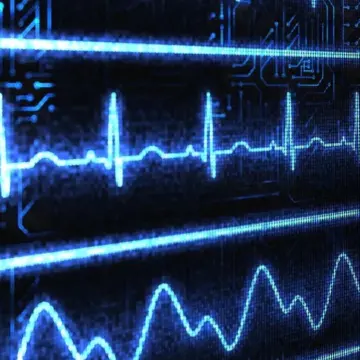 Η AI εντοπίζει καρδιακή ανεπάρκεια σε 2 δευτερόλεπτα μέσω απλού ηλεκτροκαρδιογραφήματος